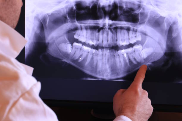 Best Emergency Dentist for Knocked-Out Tooth in Sharpsville, PA