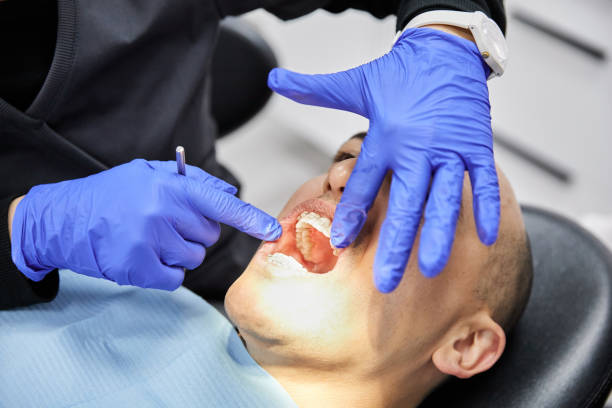 Best Emergency Dentist for Lost Fillings or Crowns in Sharpsville, PA