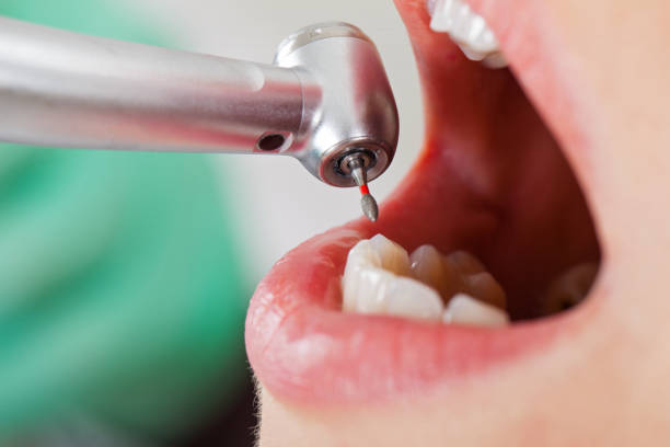 Best Emergency Root Canal Treatment in Sharpsville, PA